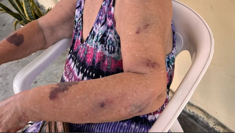 Captura de tela 2023-06-26 181732 Idosa de 87 anos é agredida pela neta com cabo de vassoura