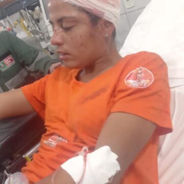 DESESPERO .Militante de Nilvan é gravemente ferida, na frente de comitê de apoiadores de Jackson e Panta