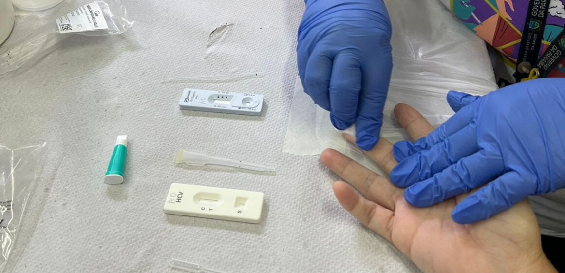 unnamed (3) Julho Amarelo: SES intensifica ações contra hepatites virais e se destaca com inovação e agilidade na prevenção e diagnóstico