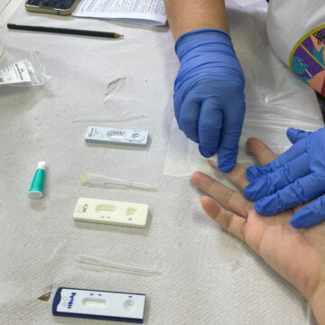 unnamed (3) Julho Amarelo: SES intensifica ações contra hepatites virais e se destaca com inovação e agilidade na prevenção e diagnóstico