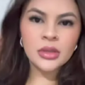 Mulher tem mãos decepadas com foice pelo namorado e cunhado